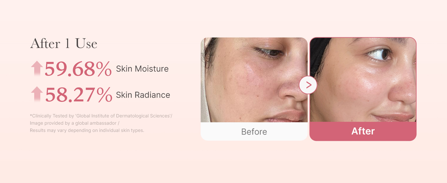 Medicube - Collagen Milk Toning Wrapping Mask | After 1 use | +59.68% Skin Moisture | +58.27% Skin Radiance | * Clinically Tested by 'Global Institute of Dermatological Sciences'. Image provided by a global ambassador. Results may vary depending on individual skin types.