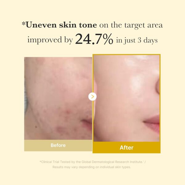Medicube - Kojic Acid Turmeric Night Wrapping Mask - Uneven skin tone on the target area improved by 24.7% in just 3 days | * Clinical Trial Tested by the Global Dermatological Research Institute. Results may vary depending on individual skin types.